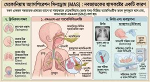 মেকোনিয়াম-অ্যাসপিরেশন-সিনড্রোম-(MAS)-nobojatok-hospital